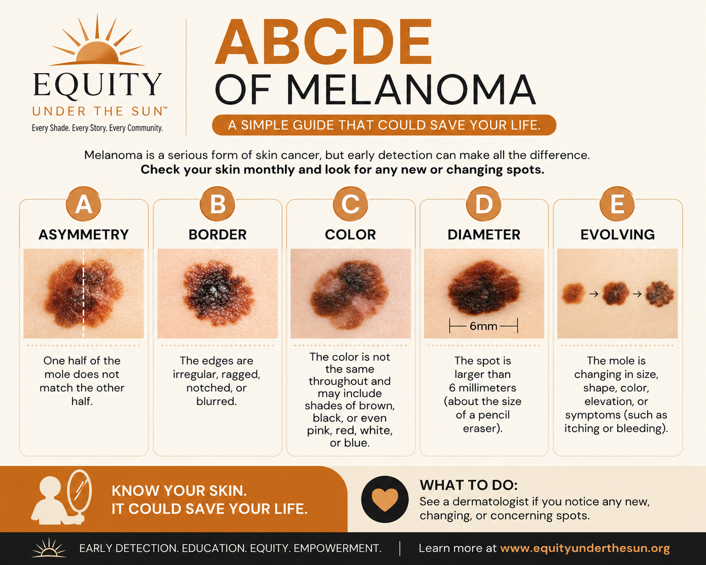ABCDEs of Melanoma guide
