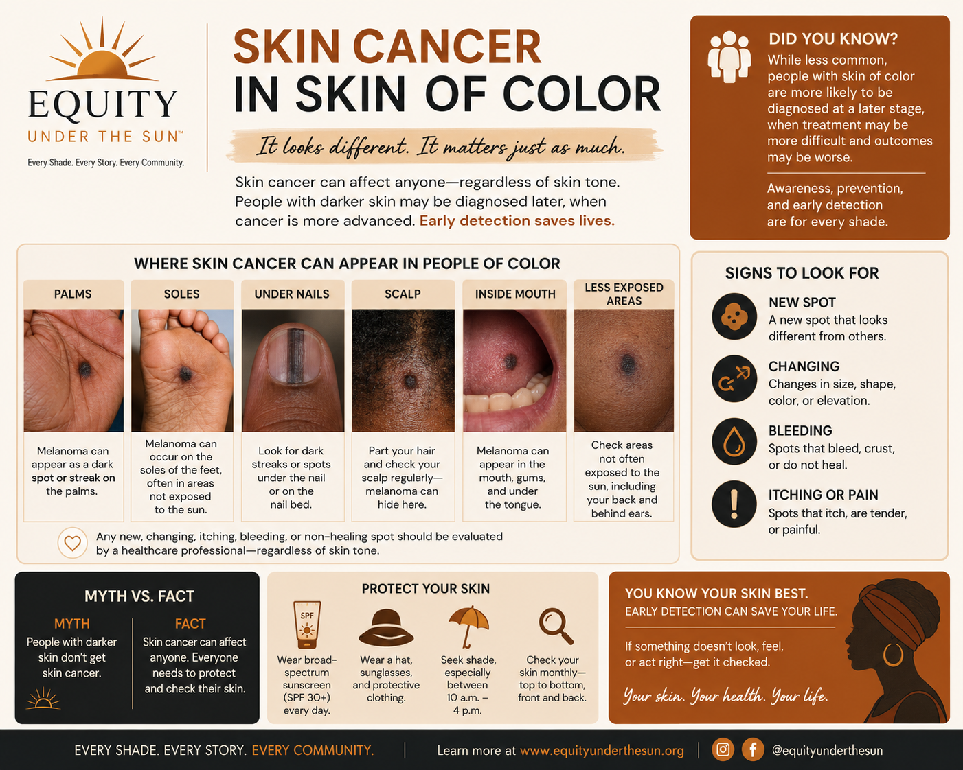 Skin Cancer in Skin of Color guide